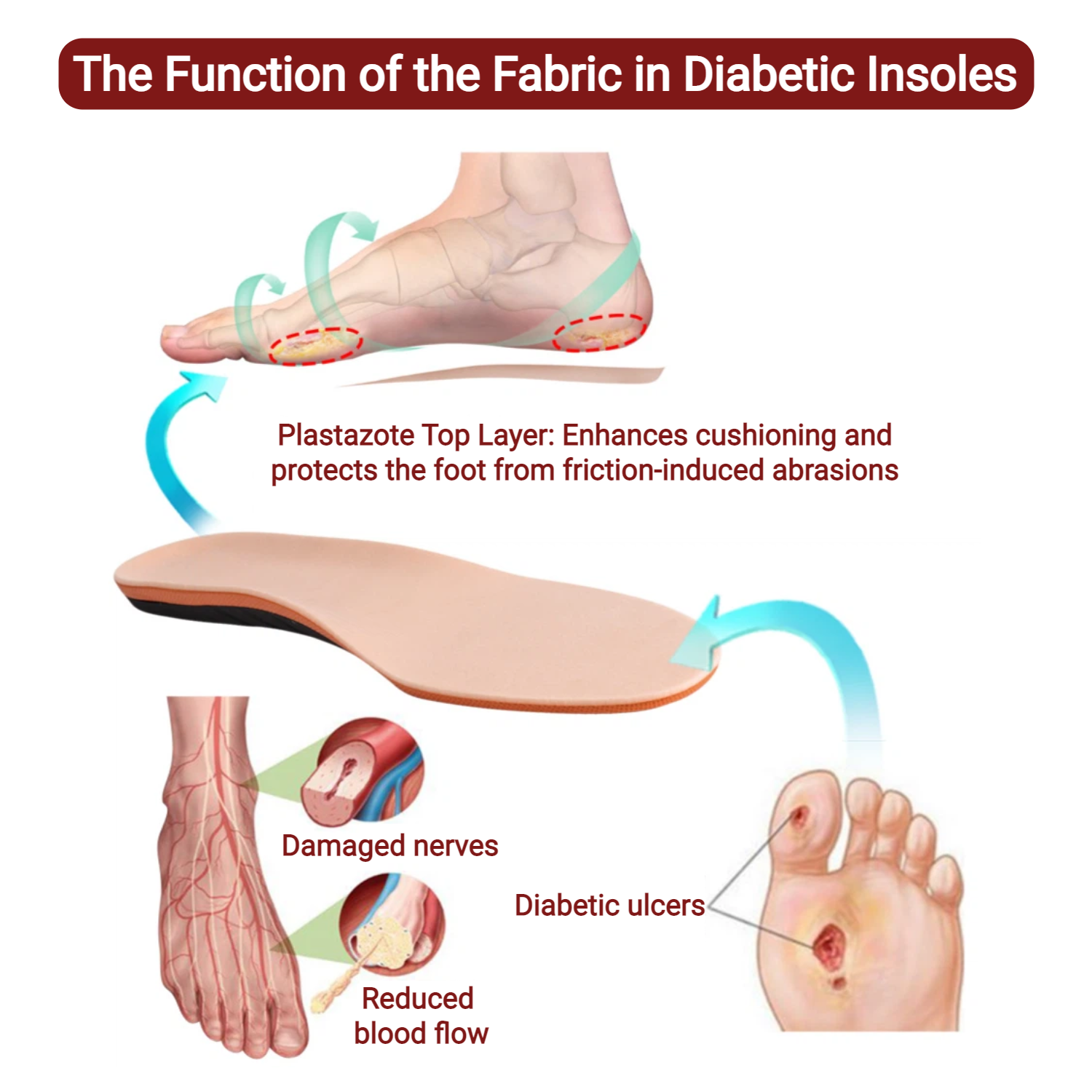 Diabetic Orthotic Insoles for Sensitive Feet – Tri-Layer Shock Absorbing Arch Support Inserts - Image 4
